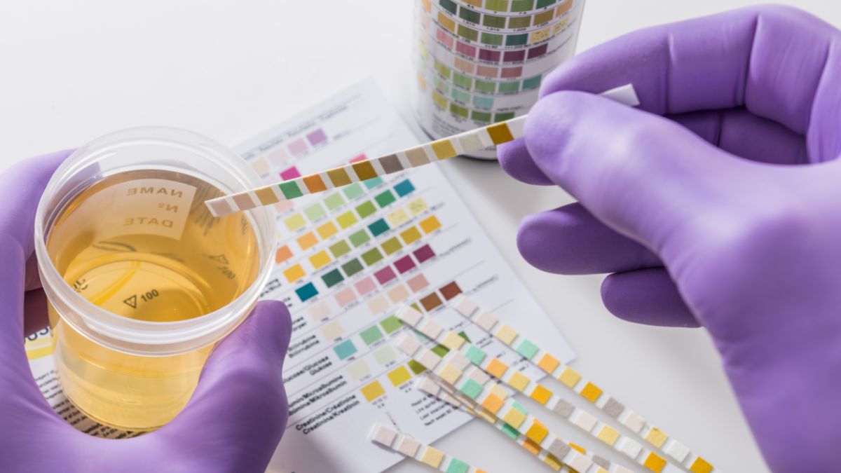 Testovacie prúžky na moč pomáhajú k rýchlej diagnostike moču. Zdroj foto: Canva Testovacie prúžky na moč pomáhajú k rýchlej diagnostike moču. Zdroj foto: Canva
